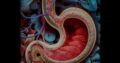 GASTROENTEROLOGIA Y CIRUGIA
