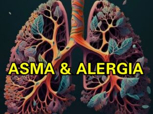 ASMA Y ALERGIA