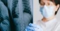 MEDICINA INTERNA