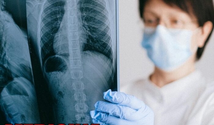 MEDICINA INTERNA