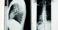 ORTOPEDIA Y TRAUMA COLUMNA VERTEBRAL