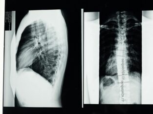 ORTOPEDIA Y TRAUMA COLUMNA VERTEBRAL
