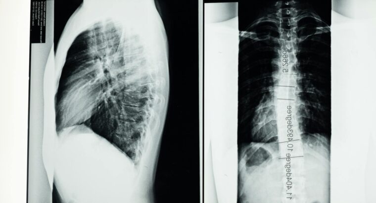 ORTOPEDIA Y TRAUMA COLUMNA VERTEBRAL